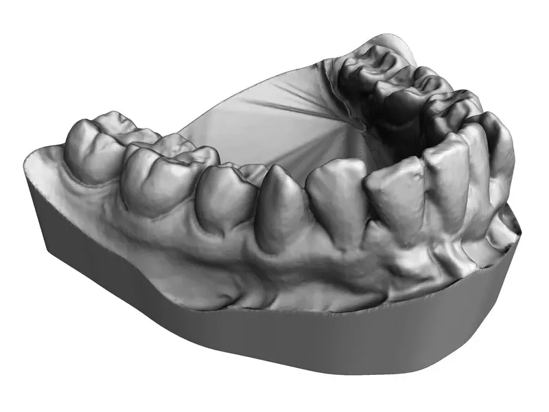Teeth 3D Scanning Service Europac 3D